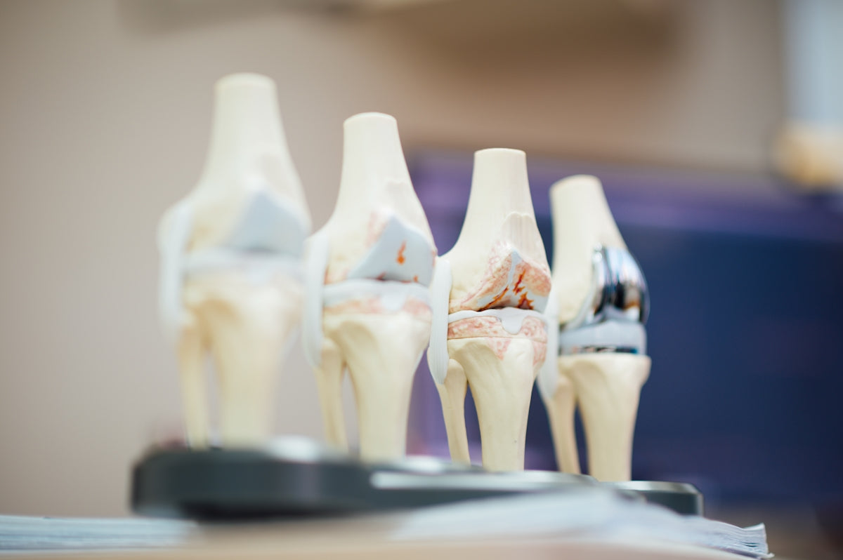 Understanding Joint Pain: Causes and Solutions – Eien Health