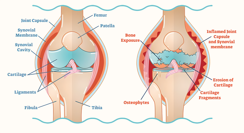 Triple Power® Joint Support